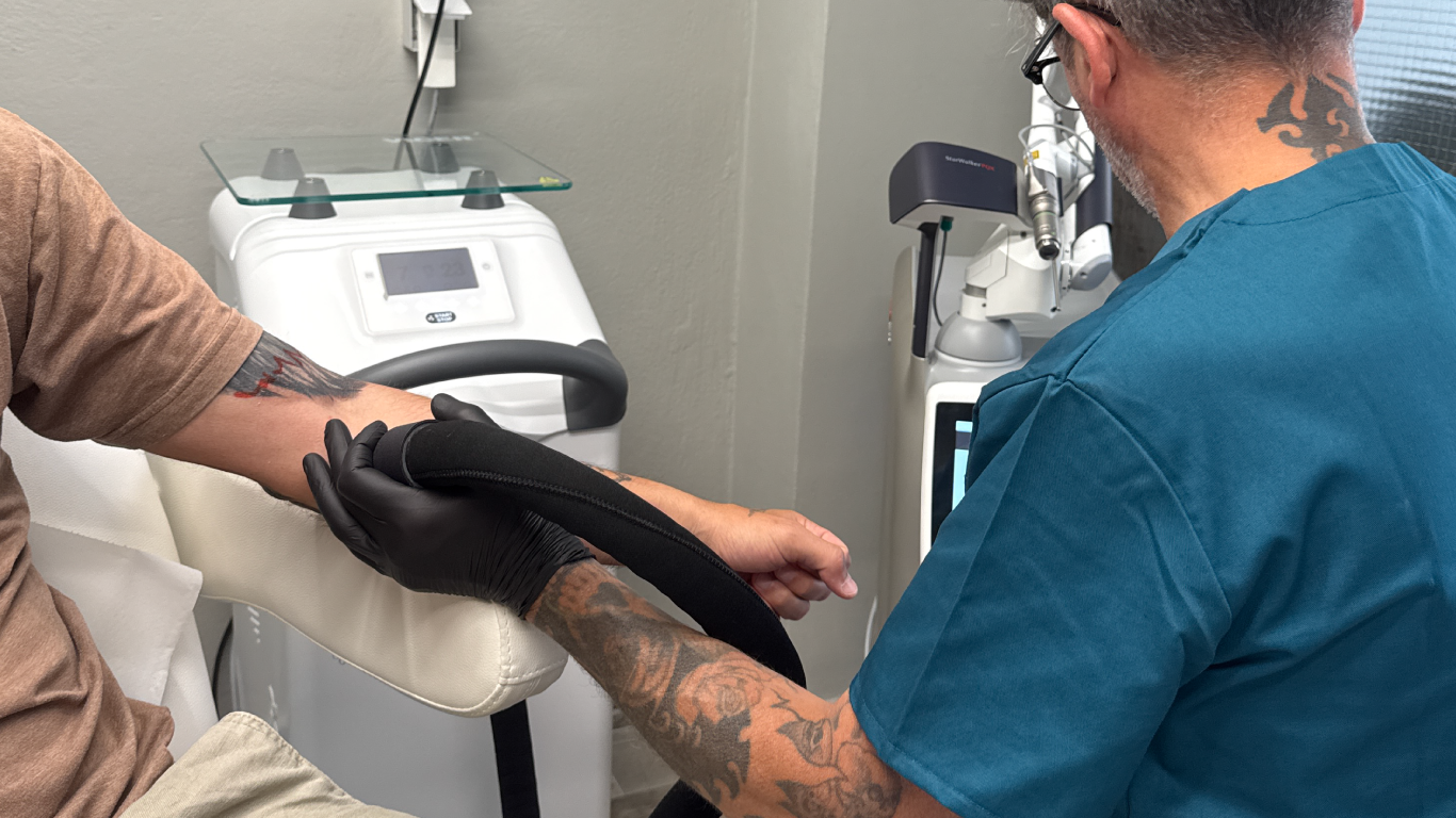 Αφαίρεση Τατουάζ